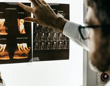 Установка коронок